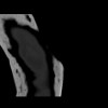 SPORK, NICO - 22.03.1976 - 02.08.2022 - CT obere Extremität - 18:01:46